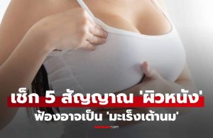 แพทย์เตือน! 5 สัญญาณ ‘ผิวหนัง’ ฟ้อง ‘มะเร็งเต้านม’ แม้คลำไม่เจอก้อน
